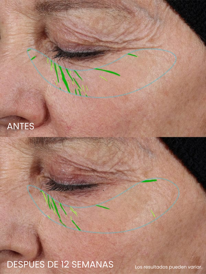 Sérum de Factores de Crecimiento sin Agujas – Efecto Rejuvenecedor