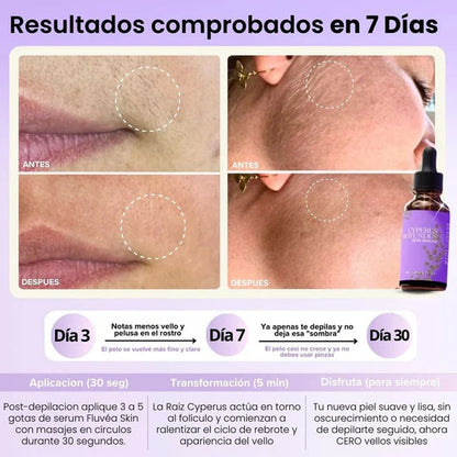 Velisse™ - Vello más fino y crecimiento más lento en semanas