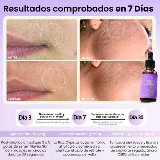 Velisse™ - Vello más fino y crecimiento más lento en semanas