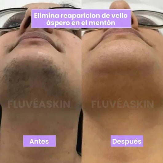 Velisse™ - Vello más fino y crecimiento más lento en semanas