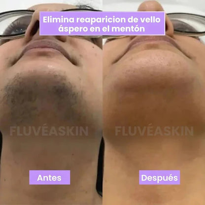 Velisse™ - Vello más fino y crecimiento más lento en semanas