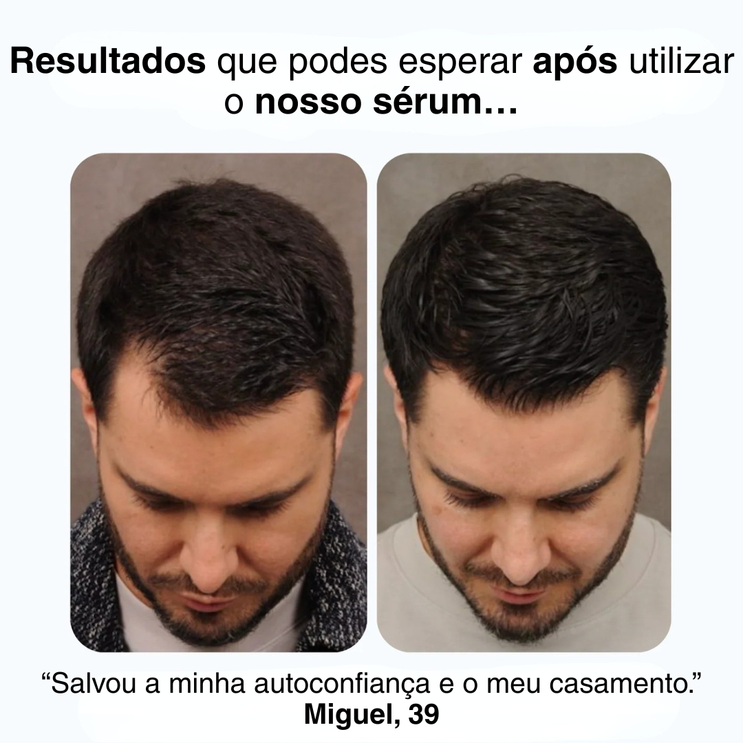 Sérum de Revitalização do Crescimento Capilar