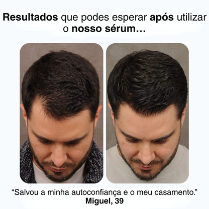 Sérum de Revitalização do Crescimento Capilar